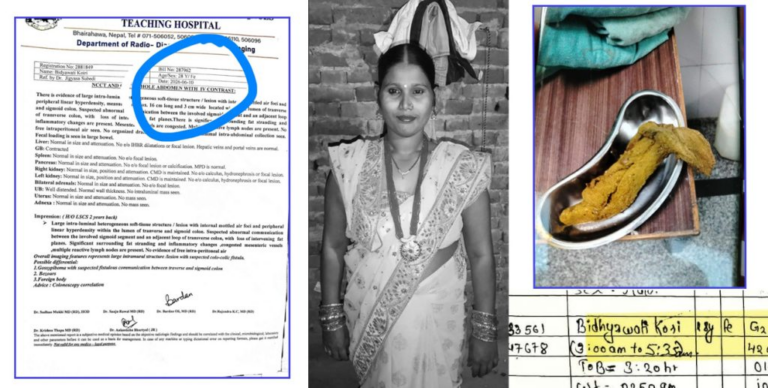 सुत्केरीपछि कहिल्यै निको भइनन्, १५ महिनापछि मृत्युले जन्मायो ठूलो प्रश्न